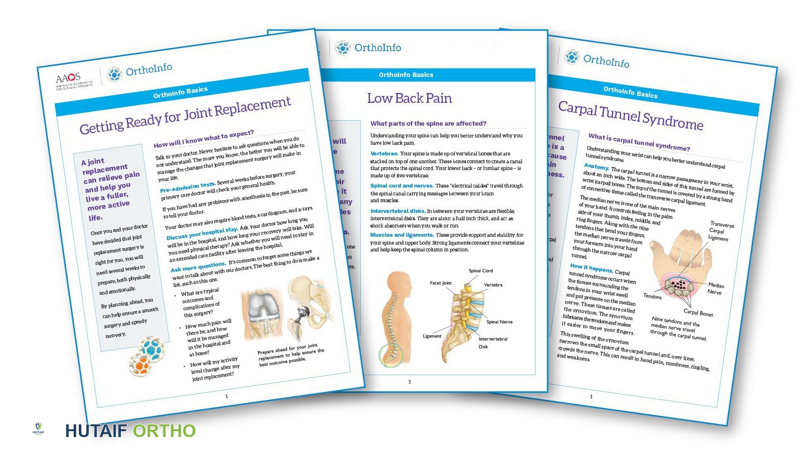 معلومات إضافية عن الكتف المتجمد